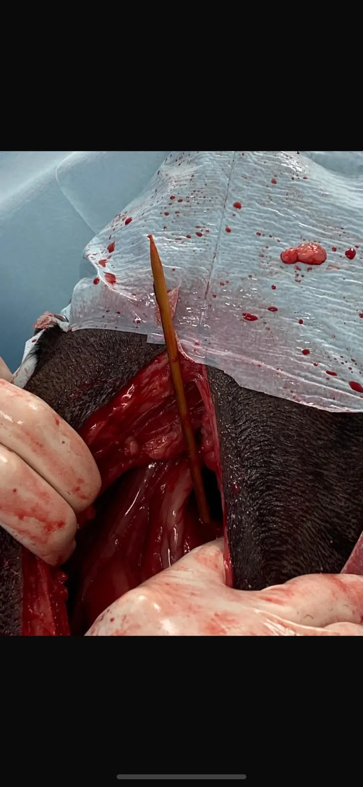 Extracción quirúrgica de un pincho de madera clavado en el estómago de un perro