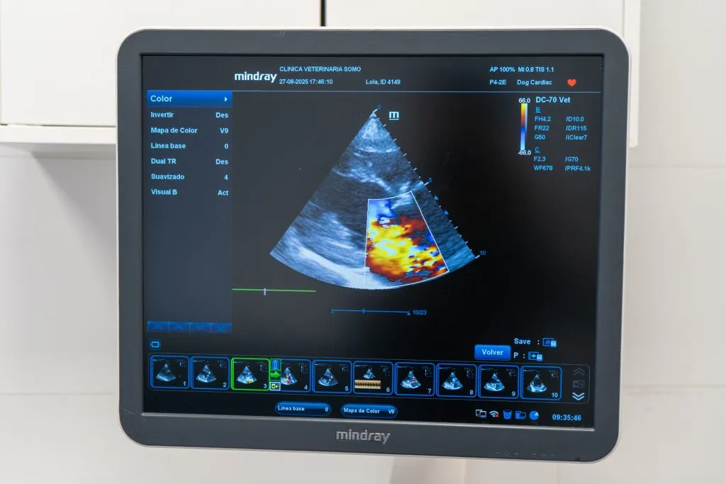 Abdominal ultrasound and cardiology